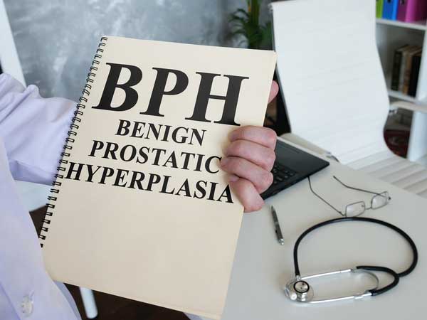 5 Best Herbs to Naturally Treat Enlarged Prostate (Benign Prostatic Hyperplasia)